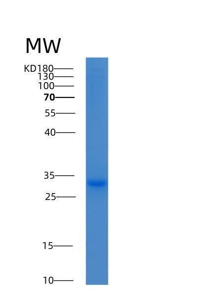 Human YWHAH (14-3-3 Protein Eta) - Recombinant Protein