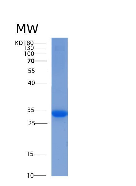 Human YWHAE (14-3-3 Protein Epsilon) - Recombinant Protein