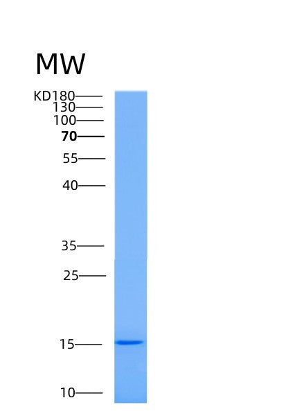Human AAMDC (Mth938 Domain-Containing Protein) - Recombinant Protein