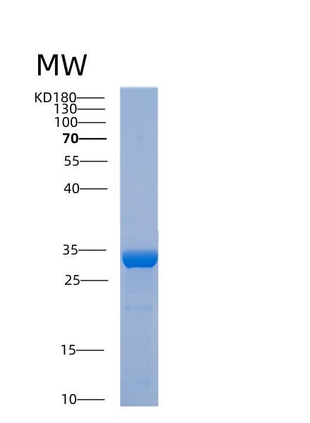 Human ABHD10 (Palmitoyl-Protein Thioesterase Abhd10, Mitochondrial) - Recombinant Protein