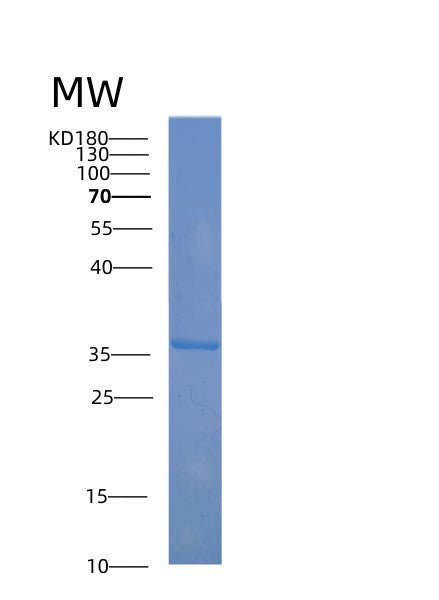 Human ABO (Histo-Blood Group Abo System Transferase) - Recombinant Protein
