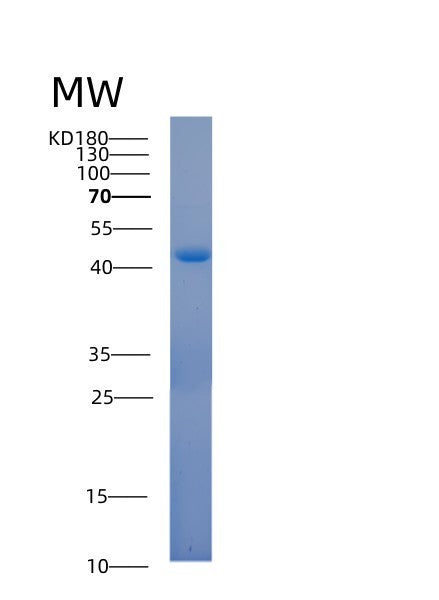Human ACOT7 (Cytosolic Acyl Coenzyme A Thioester Hydrolase) - Recombinant Protein