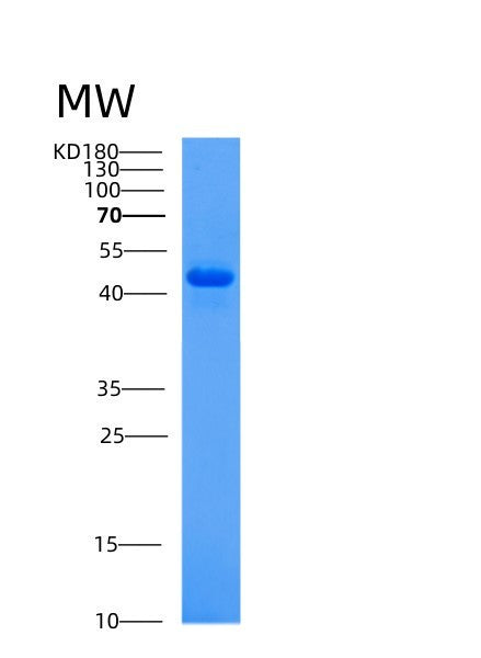 Human ACP2 (Lysosomal Acid Phosphatase) - Recombinant Protein