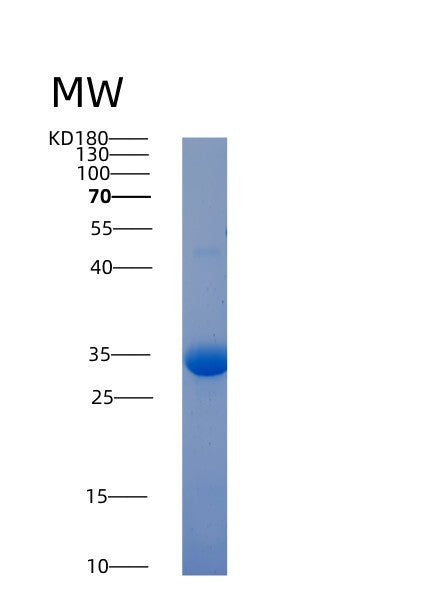 Human ACP5 (Tartrate-Resistant Acid Phosphatase Type 5) - Recombinant Protein