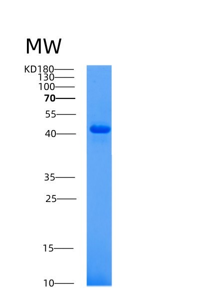 Human ACP3 (Prostatic Acid Phosphatase) - Recombinant Protein
