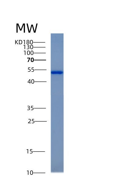 Human ACY1 (Aminoacylase-1) - Recombinant Protein