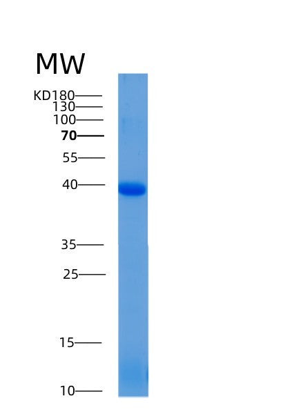 Human ADH1A (Alcohol Dehydrogenase 1A) - Recombinant Protein