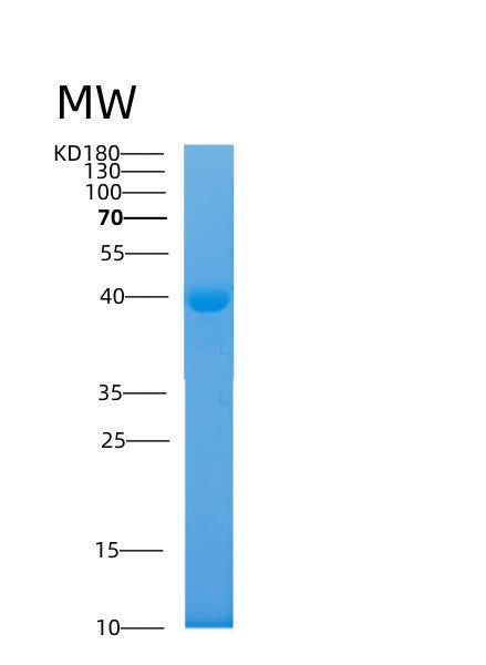 Human ADH1C (Alcohol Dehydrogenase 1C) - Recombinant Protein