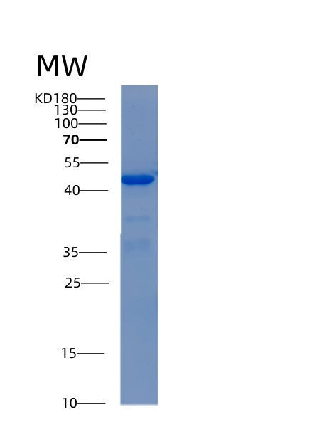 Human ADH5 (Alcohol Dehydrogenase Class-3) - Recombinant Protein