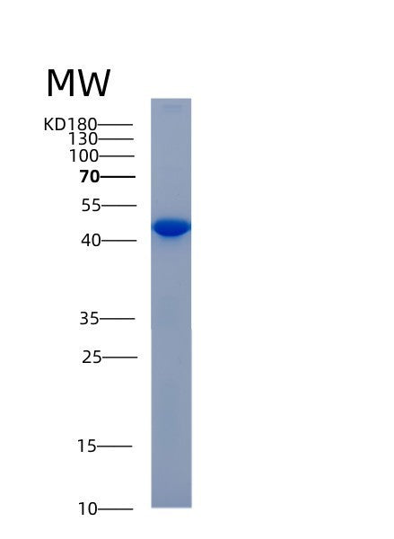 Human ADH6 (Alcohol Dehydrogenase 6) - Recombinant Protein