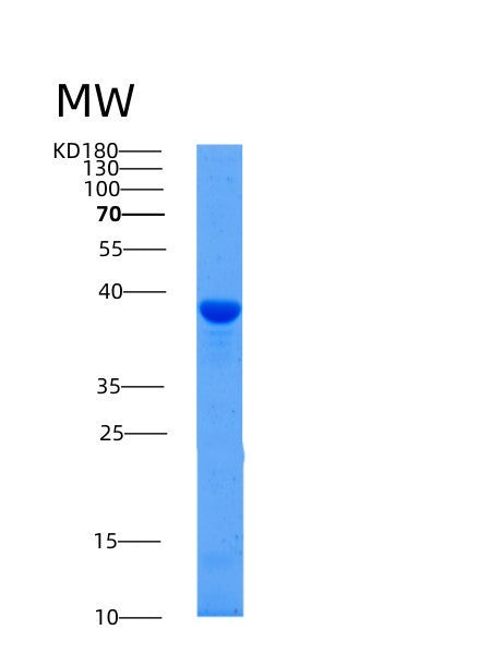Human AFAP1 (Actin Filament-Associated Protein 1) - Recombinant Protein