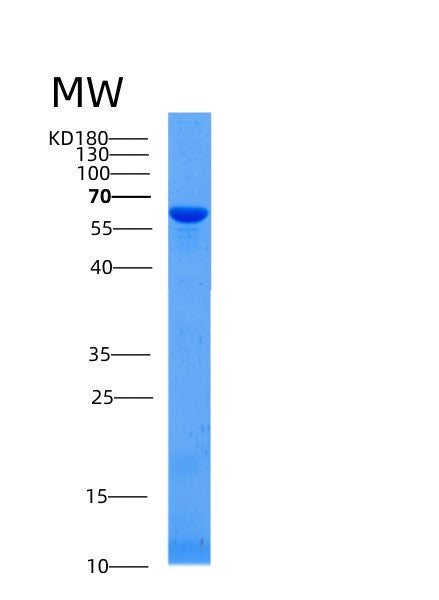 Human AFP (Alpha-Fetoprotein) - Recombinant Protein