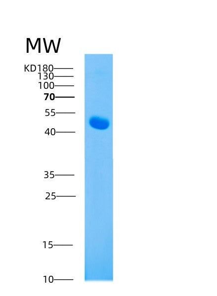 Mouse Ahsg (Alpha-2-Hs-Glycoprotein) - Recombinant Protein