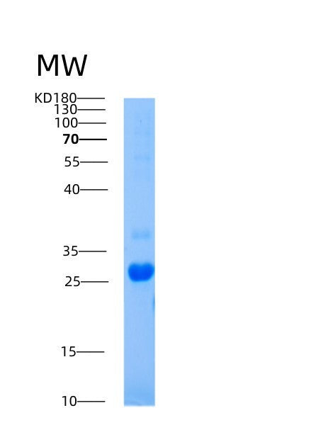 Human AICDA (Single-Stranded Dna Cytosine Deaminase) - Recombinant Protein