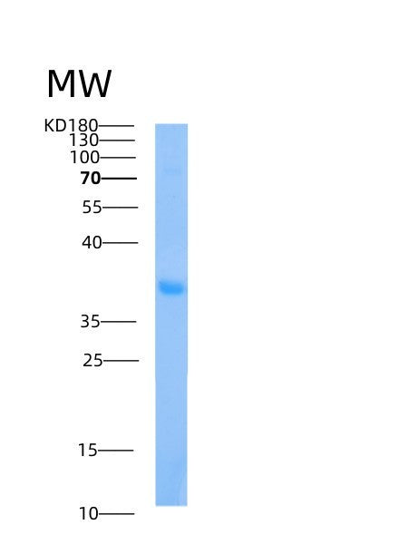 Human AIDA (Axin Interactor, Dorsalization-Associated Protein) - Recombinant Protein