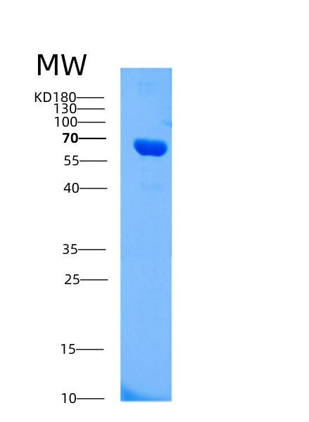 Human AIFM1 (Apoptosis-Inducing Factor 1, Mitochondrial) - Recombinant Protein