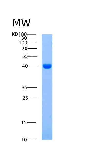 Human AIMP1 (Aminoacyl Trna Synthase Complex-Interacting Multifunctional Protein 1) - Recombinant Protein