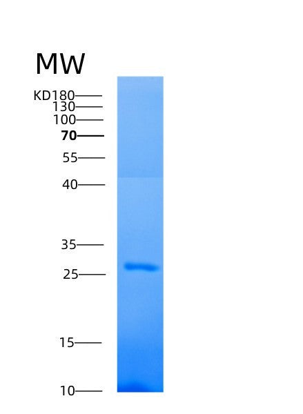 Human AK4 (Adenylate Kinase 4, Mitochondrial) - Recombinant Protein