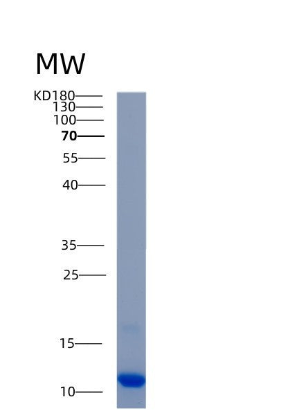 Human AKAP7 (A-Kinase Anchor Protein 7 Isoform Gamma) - Recombinant Protein