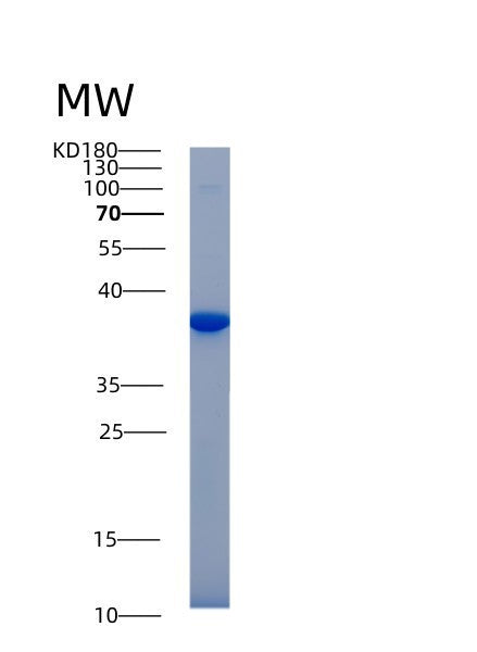 Mouse Akr1b1 (Aldo-Keto Reductase Family 1 Member B1) - Recombinant Protein