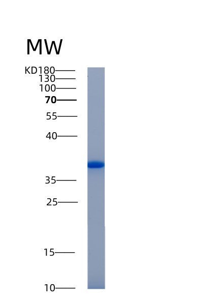 Human AKR1B10 (Aldo-Keto Reductase Family 1 Member B10) - Recombinant Protein