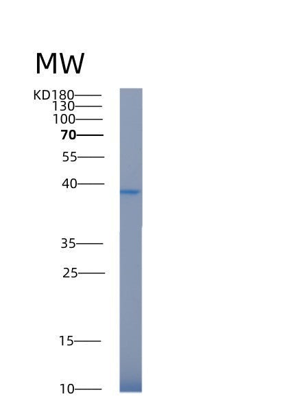 Human AKR1C3 (Aldo-Keto Reductase Family 1 Member C3) - Recombinant Protein