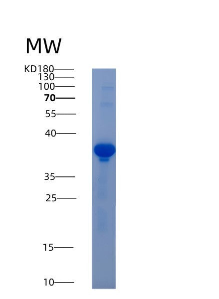 Human AKR1D1 (Aldo-Keto Reductase Family 1 Member D1) - Recombinant Protein