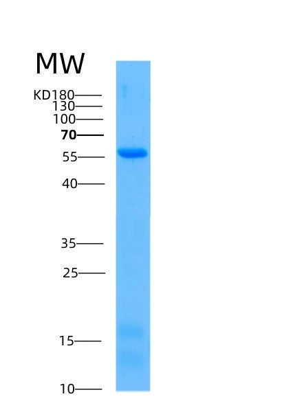 Human AKT1 (Rac-Alpha Serine/Threonine-Protein Kinase) - Recombinant Protein