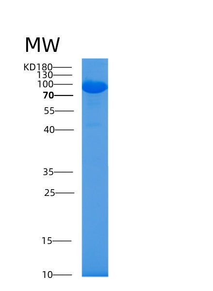 Human AARS1 (Alanine--Trna Ligase, Cytoplasmic) - Recombinant Protein
