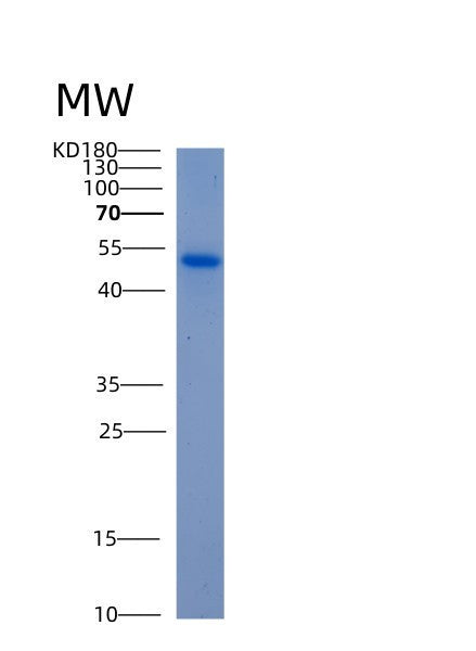 Human ALDH5A1 (Succinate-Semialdehyde Dehydrogenase, Mitochondrial) - Recombinant Protein