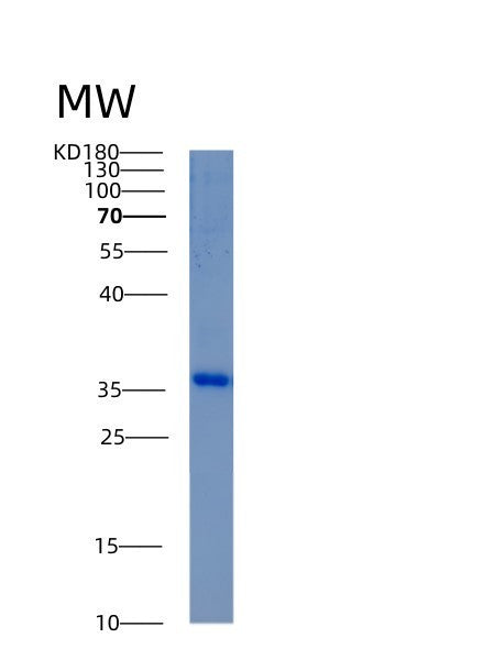Human AKR1C3 (Aldo-Keto Reductase Family 1 Member C3) - Recombinant Protein
