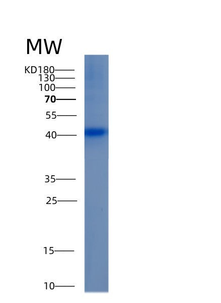 Human ALDOB (Fructose-Bisphosphate Aldolase B) - Recombinant Protein