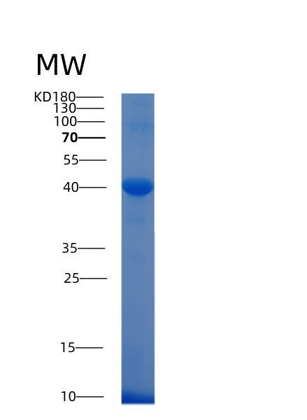 Human ALDOC (Fructose-Bisphosphate Aldolase C) - Recombinant Protein