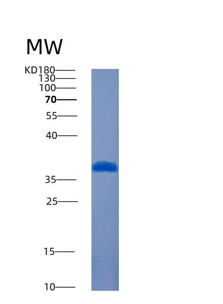 Human AMMECR1L (Ammecr1-Like Protein) - Recombinant Protein