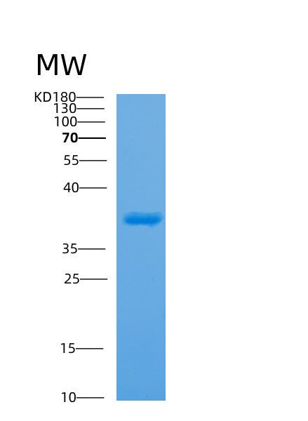 Human APOH (Beta-2-Glycoprotein 1) - Recombinant Protein