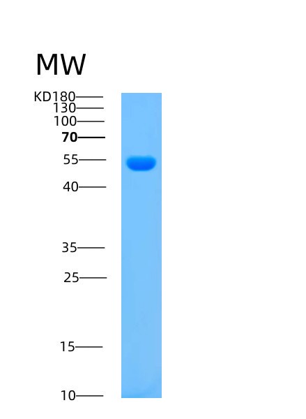 Mouse Arsa (Arylsulfatase A) - Recombinant Protein