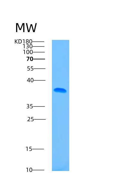 Human ASPA (Aspartoacylase) - Recombinant Protein