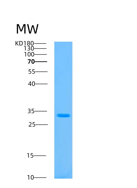 Human ATP5F1C (Atp Synthase Subunit Gamma, Mitochondrial) - Recombinant Protein