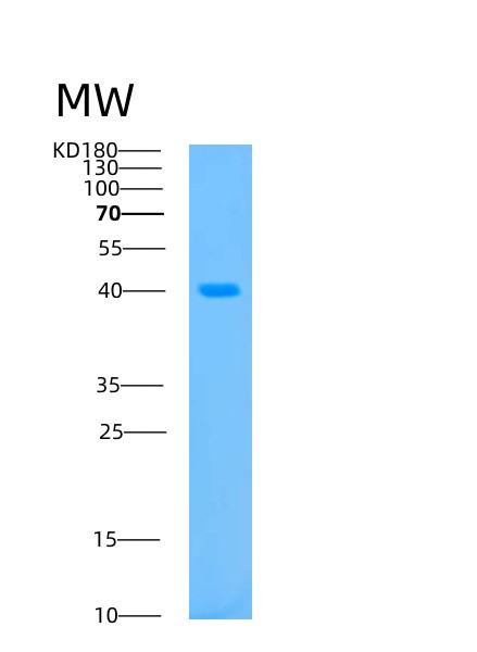 Human AURKB (Aurora Kinase B) - Recombinant Protein