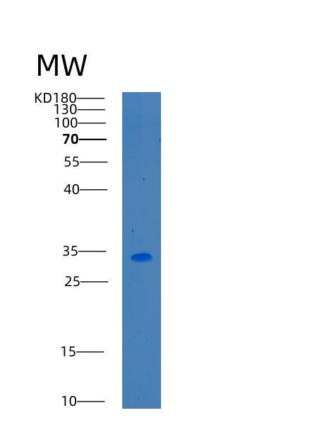 Human CA14 (Carbonic Anhydrase 14) - Recombinant Protein