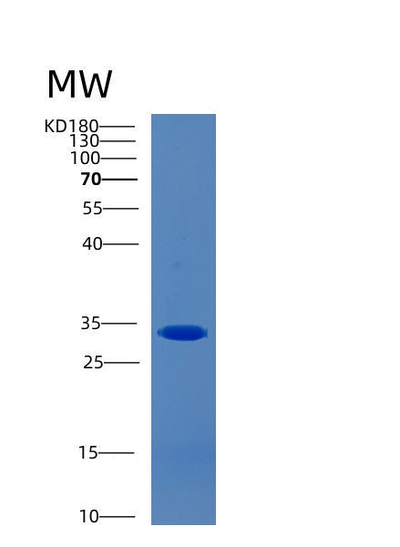 Human CAPZA2 (F-Actin-Capping Protein Subunit Alpha-2) - Recombinant Protein
