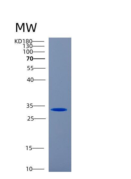 Human CA1 (Carbonic Anhydrase 1) - Recombinant Protein