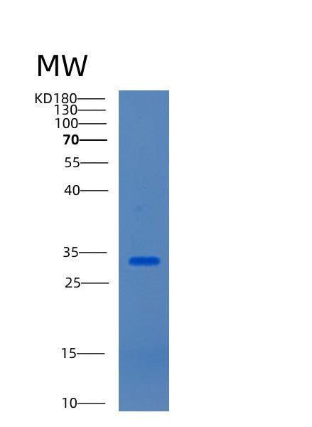 Mouse Ctsz (Cathepsin Z) - Recombinant Protein