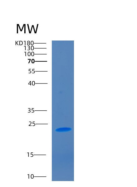 Human CD2 (T-Cell Surface Antigen Cd2) - Recombinant Protein