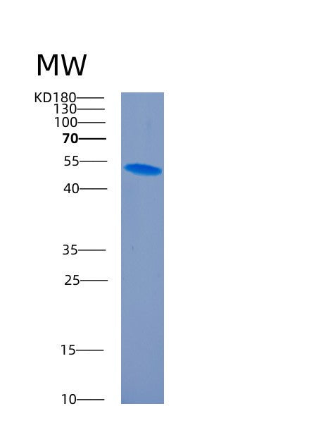 Human CD200 (Ox-2 Membrane Glycoprotein) - Recombinant Protein