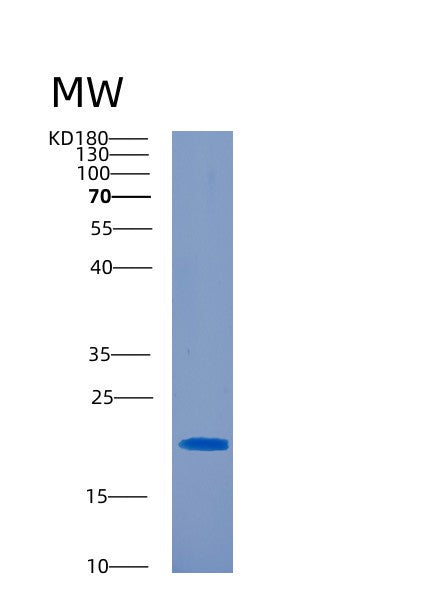 Human CD300C (Cmrf35-Like Molecule 6) - Recombinant Protein
