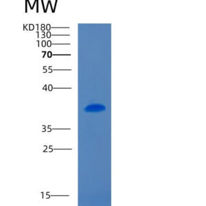 Mouse Cd5l (Cd5 Antigen-Like) - Recombinant Protein