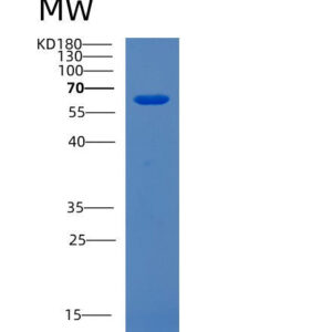 Human CDK5RAP3 (Cdk5 Regulatory Subunit-Associated Protein 3) - Recombinant Protein