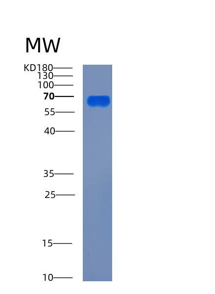 Mouse Ces1 (Liver Carboxylesterase 1) - Recombinant Protein