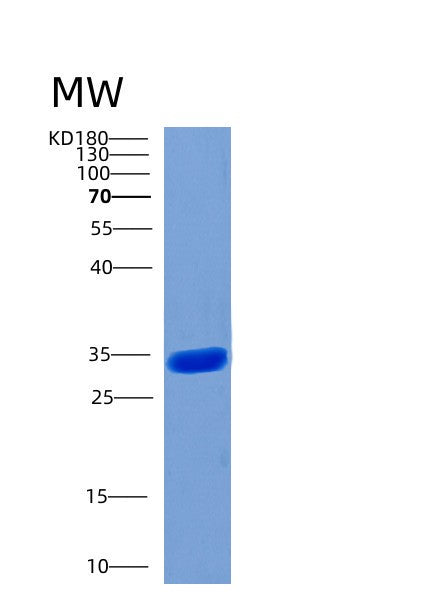 Human STUB1 (E3 Ubiquitin-Protein Ligase Chip) - Recombinant Protein